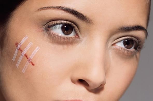 Как вылечить неглубокую рану на лице