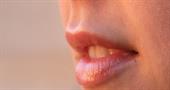 Как побороть сухость и шелушение губ?